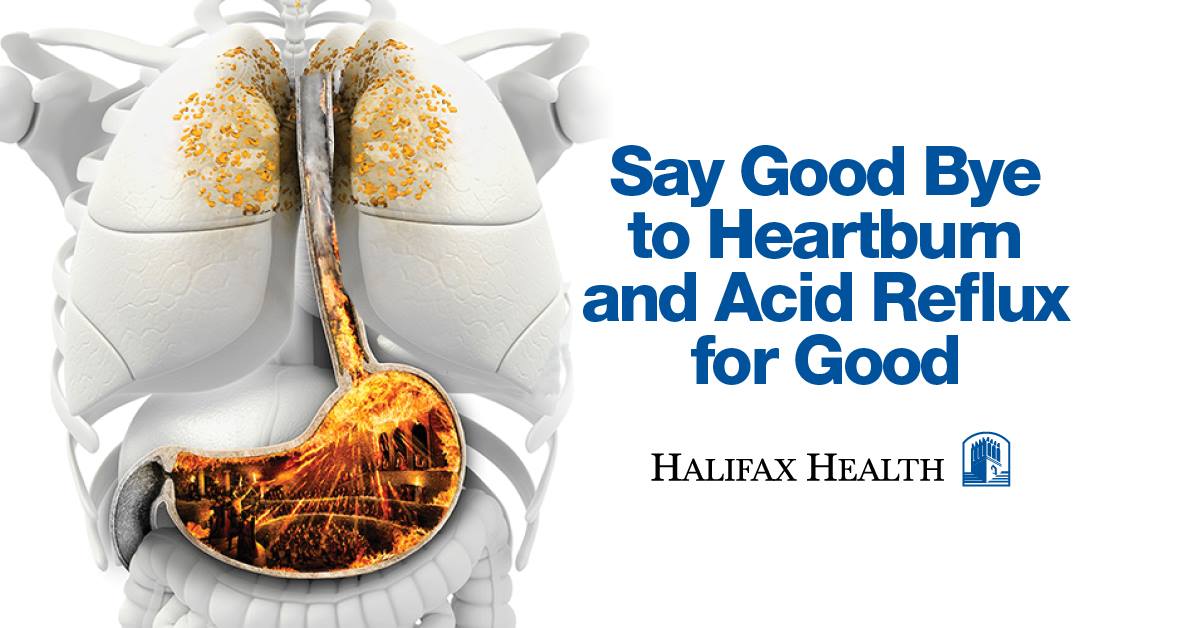 Halifax Health to Host “Say Goodbye to Heartburn and Acid Reflux for Good”